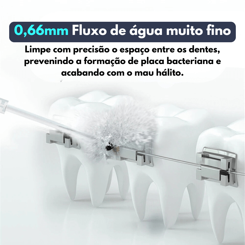 Irrigador Oral Limpeza Profunda RECARREGÁVEL - 4 BOCAIS DIFERENTES - FRETE GRÁTIS